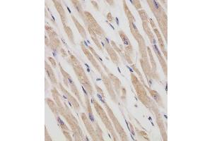 (ABIN6242408 and ABIN6577250) staining RANBP9 in human heart tissue sections by Immunohistochemistry (IHC-P - paraformaldehyde-fixed, paraffin-embedded sections). (Importin 9 anticorps  (AA 1-388))
