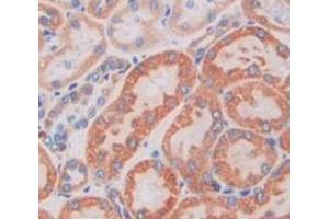 IHC-P analysis of Kidney tissue, with DAB staining. (M6PR anticorps  (AA 27-185))