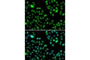 Immunofluorescence analysis of MCF-7 cells using L3MBTL3 antibody (ABIN5974391). (L3MBTL3 anticorps)