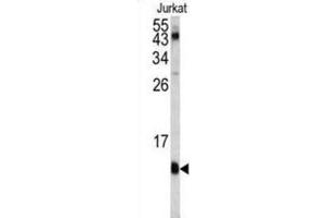 Western Blotting (WB) image for anti-FK506 Binding Protein 1A, 12kDa (FKBP1A) antibody (ABIN3003472)