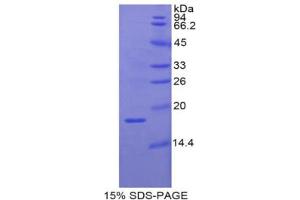SDS-PAGE analysis of Pig RBP2 Protein. (RBP2 Protéine)