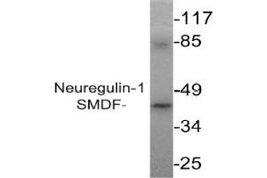 Image no. 2 for anti-Neuregulin 1 (NRG1) antibody (ABIN265466) (Neuregulin 1 anticorps)