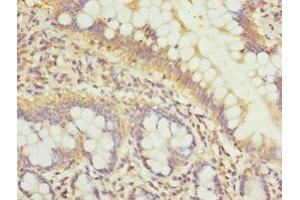 Immunohistochemistry of paraffin-embedded human small intestine tissue using ABIN7163882 at dilution of 1:100 (GALNT3 anticorps  (AA 1-140))
