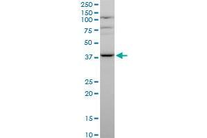 MVK polyclonal antibody (A01), Lot # 051116JC01. (MVK anticorps  (AA 297-396))