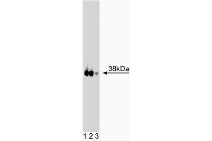 Western blot analysis of JAM-1 on human endothelial lysate. (F11R anticorps  (AA 126-237))