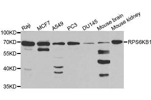 Western blot analysis of extracts of various cell lines, using RPS6KB1 antibody. (RPS6KB1 anticorps  (AA 1-352))