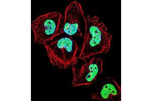 Immunofluorescence (IF) image for anti-Zinc Finger Protein 155 (ZNF155) antibody (ABIN2999111) (ZNF155 anticorps)