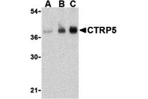 Western Blotting (WB) image for anti-C1q and Tumor Necrosis Factor Related Protein 5 (C1QTNF5) (N-Term) antibody (ABIN1031332) (CTRP5 anticorps  (N-Term))