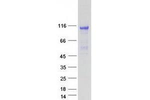 Validation with Western Blot