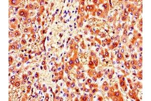 Immunohistochemistry of paraffin-embedded human liver tissue using ABIN7146178 at dilution of 1:100 (ZMPSTE24 anticorps  (AA 217-347))