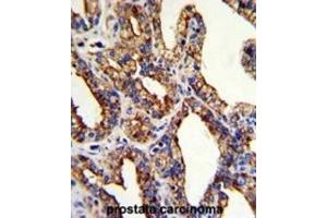 Immunohistochemistry (IHC) image for anti-Tumor-Associated Calcium Signal Transducer 2 (TACSTD2) antibody (ABIN3002746)