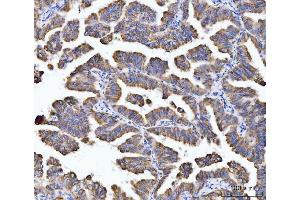 IHC analysis of Aconitase 2 using anti-Aconitase 2 antibody (ABIN7602770). (ACO2 anticorps  (C-Term))
