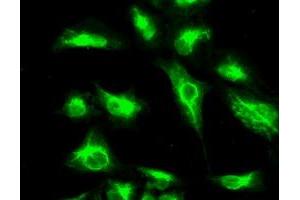 Image no. 3 for anti-Cancer/testis Antigen 1B (CTAG1B) antibody (ABIN1499904) (CTAG1B anticorps)