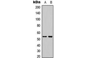 Western blot analysis of STEAP3 expression in HeLa (A), HepG2 (B) whole cell lysates. (STEAP3 anticorps  (C-Term))