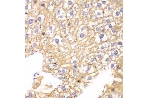 Immunohistochemistry of paraffin-embedded mouse liver using PPP2R2A antibody at dilution of 1:100 (400x lens). (PPP2R2A anticorps)