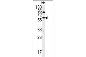 Western blot analysis of anti-ANTXR1 Antibody  (ABIN392154 and ABIN2841879) in Hela cell line lysates (35 μg/lane). (ANTXR1 anticorps  (AA 358-386))