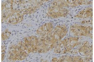 ABIN6273649 at 1/100 staining Human uterus tissue by IHC-P. (IL12B anticorps  (C-Term))