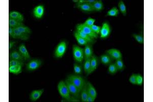 Immunofluorescence staining of HepG2 cells with ABIN7165566 at 1:133, counter-stained with DAPI. (FAM83D anticorps  (AA 339-470))