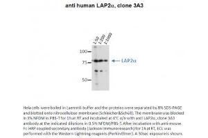 Image no. 1 for anti-Thymopoietin (TMPO) (AA 650-750) antibody (ABIN1042619) (Thymopoietin anticorps  (AA 650-750))