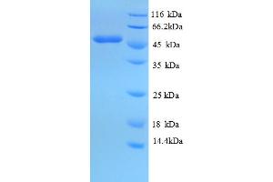 SDS-PAGE (SDS) image for Isocitrate Dehydrogenase 1 (NADP+), Soluble (IDH1) (AA 7-407), (partial) protein (His tag) (ABIN5709697)