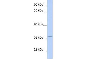 WB Suggested Anti-FBXO27 Antibody Titration: 0. (FBXO27 anticorps  (Middle Region))