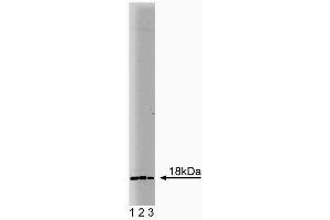 Western blot analysis of Ubc9 on human endothelial lysate. (UBE2I anticorps  (AA 26-156))