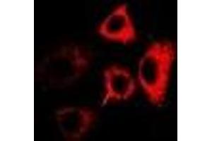 Immunofluorescent analysis of RPL13 staining in MCF7 cells.