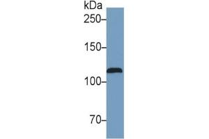 Mouse Capture antibody from the kit in WB with Positive Control:  Human Serum. (NOS2 Kit ELISA)