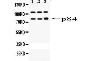 Western blot analysis of STAT1 using anti-STAT1 antibody . (STAT1 anticorps  (AA 2-230))