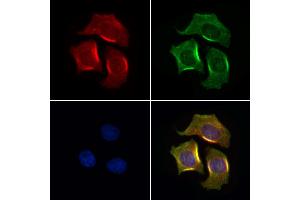 ABIN7094518 and ABIN7098567 staining HepG2 cells by IF/ICC.
