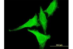 Immunofluorescence of monoclonal antibody to HSF2 on HeLa cell.