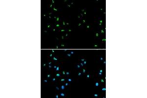 Immunofluorescence analysis of A549 cells using HDAC4 antibody. (HDAC4 anticorps  (AA 530-630))