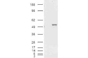 HEK293 overexpressing ALDH1A1 and probed with ABIN185587 (mock transfection in first lane). (ALDH1A1 anticorps  (Internal Region))