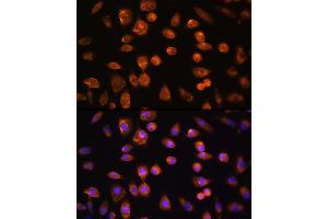 Immunofluorescence analysis of L929 cells using VEGFR3/FLT4 Rabbit pAb (ABIN6130780, ABIN6140699, ABIN6140702 and ABIN6221242) at dilution of 1:100 (40x lens).