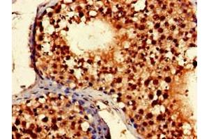 Immunohistochemistry of paraffin-embedded human testis tissue using ABIN7169201 at dilution of 1:100 (TLK2 anticorps  (AA 23-234))