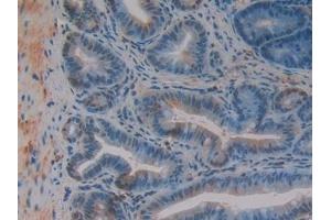 Detection of Grb7 in Mouse Intestine Tissue using Polyclonal Antibody to Growth Factor Receptor Bound Protein 7 (Grb7)