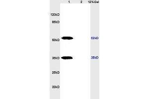 Lane 1: rat brain lysates Lane 2: rat heart lysates probed with Anti phospho-CHEK1(Ser317) Polyclonal Antibody, Unconjugated (ABIN757072) at 1:200 in 4 °C.