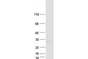 Validation with Western Blot