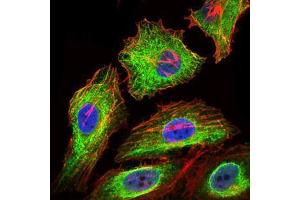 Immunofluorescence analysis of HeLa cells using GPC3 mouse mAb (green). (Glypican 3 anticorps)