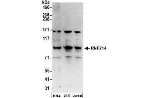 anti-Ring Finger Protein 214 (RNF214) (AA 1-50) antibody