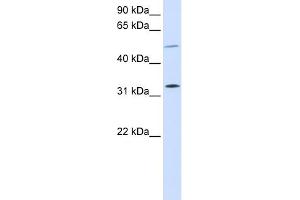 WB Suggested Anti-SHOX2 Antibody Titration: 0. (SHOX2 anticorps  (Middle Region))