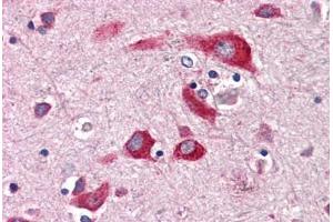 Anti-ENTPD2 antibody  ABIN1048566 IHC staining of human brain, cortex. (ENTPD2 anticorps  (Internal Region))