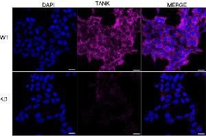 Immunocytochemical staining of HeLa cells using TANK antibody (ABIN7800580), 1:1,000), Top panel: wild-type (WT), Bottom panal: TANK shRNA knockdown (KD). (TANK anticorps)