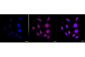 Immunocytochemical staining of HepG2 cells with Amyloid beta precursor like protein 2 antibody (ABIN7797595), 1:1,000). (Recombinant APLP2 anticorps)