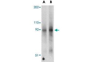 Western blot analysis of FNIP2 in mouse skeletal muscle tissue lysate with FNIP2 polyclonal antibody  at (A) 1 and (B) 2 ug/mL . (FNIP2 anticorps  (N-Term))