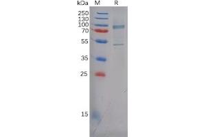 Human CDH3 Protein, His Tag on SDS-PAGE under reducing condition. (P-Cadherin Protein (CDH3) (His tag))