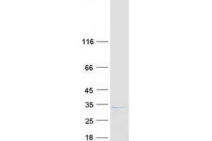 Validation with Western Blot