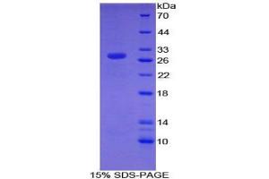 SDS-PAGE analysis of Mouse CHD3 Protein. (CHD3 Protéine)
