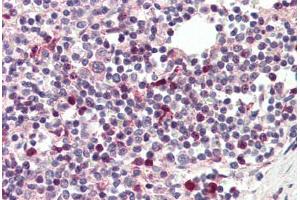 Human Spleen (formalin-fixed, paraffin-embedded) stained with TFEC antibody ABIN337184 at 5 ug/ml followed by biotinylated anti-goat IgG secondary antibody ABIN481715, alkaline phosphatase-streptavidin and chromogen. (TFEC anticorps  (AA 217-228))