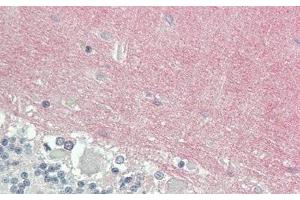 Detection of VCAN in Human Cerebellum Tissue using Polyclonal Antibody to Versican (VCAN)